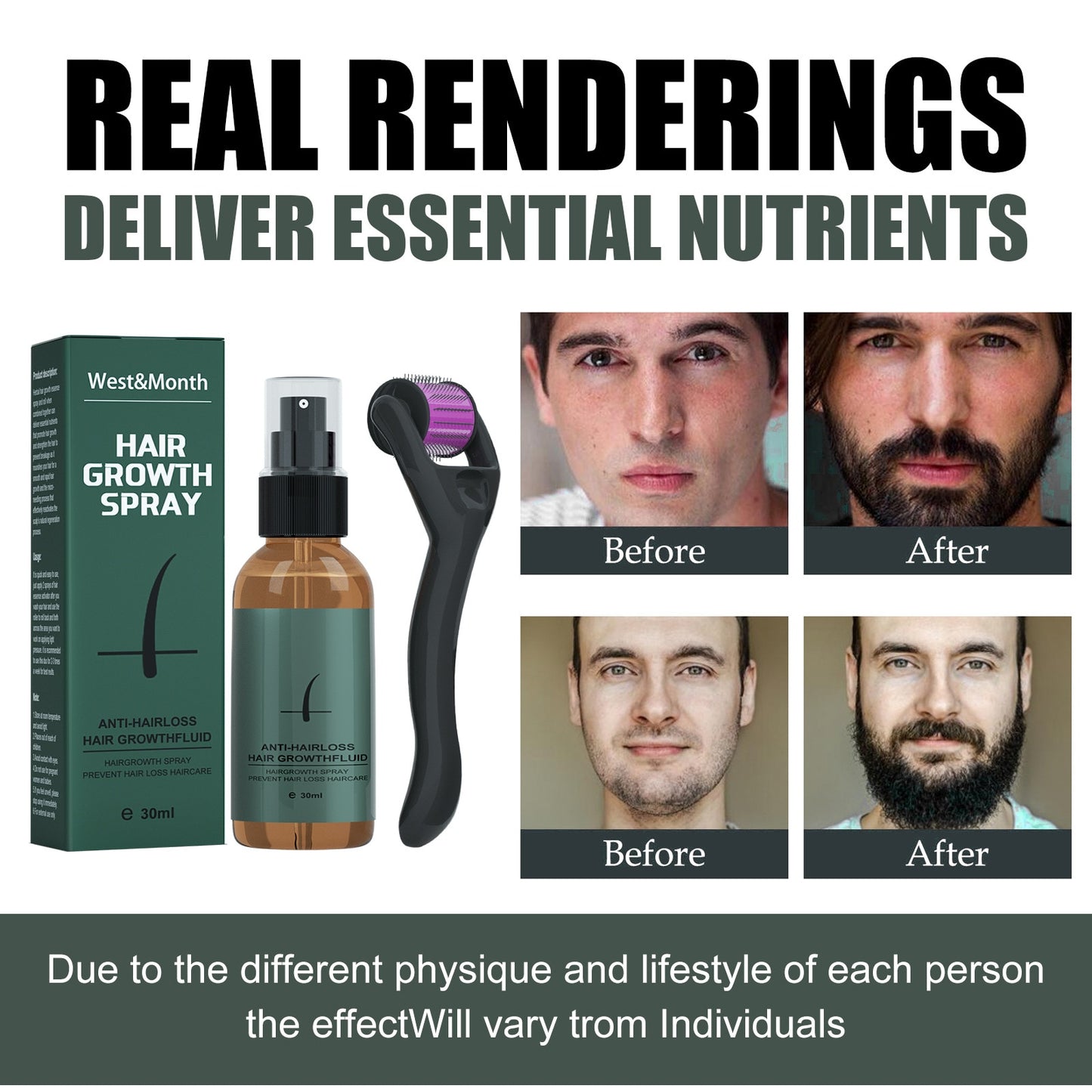 Beard Growth Spray Set for Men Nourishing Moisturizing Moustache Growth Enhancer Anti Hair Loss Care Serum with Beard Roller