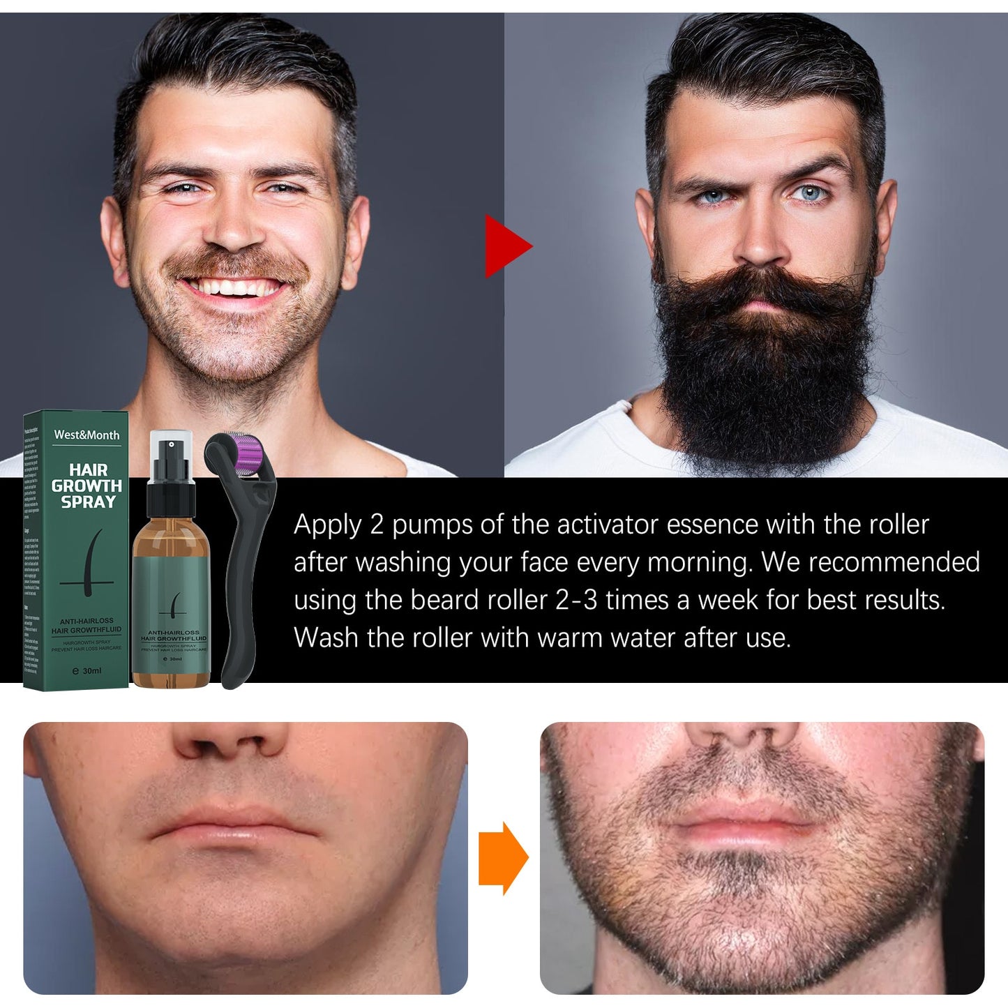 Beard Growth Spray Set for Men Nourishing Moisturizing Moustache Growth Enhancer Anti Hair Loss Care Serum with Beard Roller